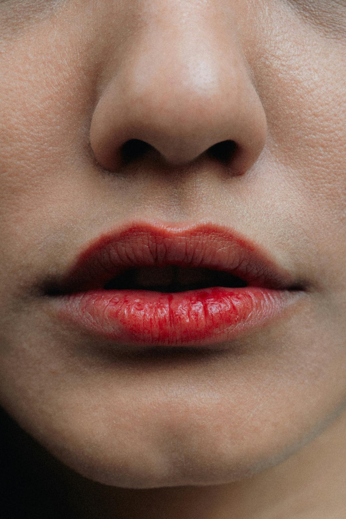 Губы &mdash; одна из самых уязвимых зон лица: кожа здесь тоньше, чем на других участках, и практически не защищена естественными механизмами