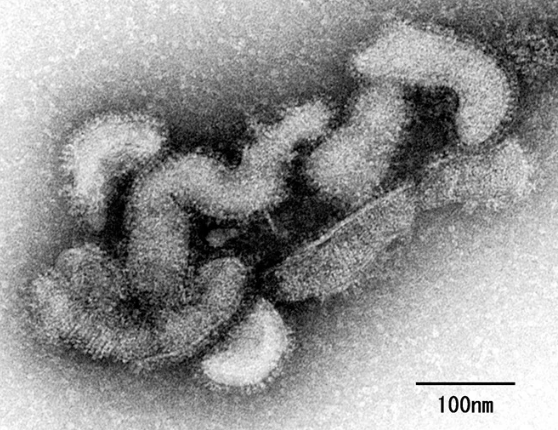 Изображение частицы вируса Оз под электронным микроскопом.