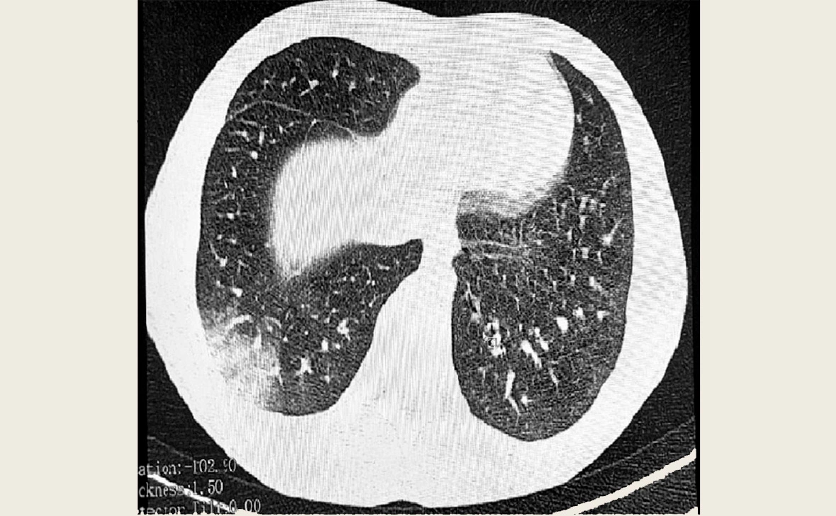 Управление Роспотребнадзора по Томской области