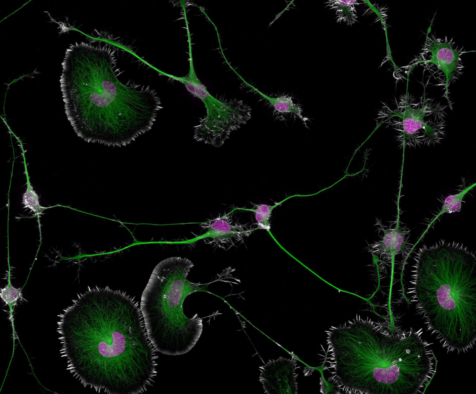 Дифференцированные клетки опухоли мозга мыши
