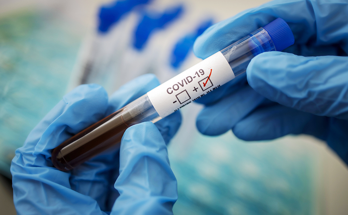 За сутки в СКФО выявили более 500 новых случаев коронавируса