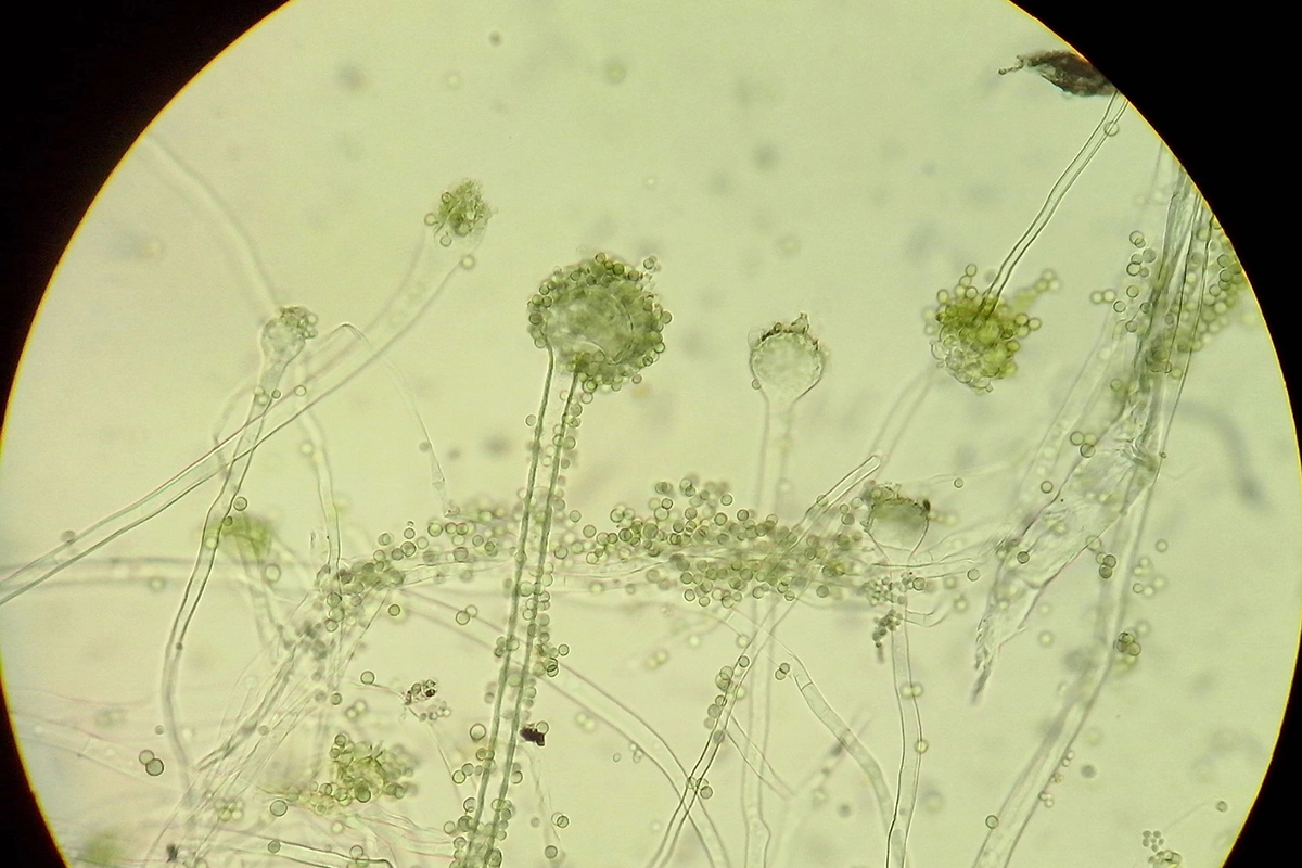 <p>Грибы Aspergillus flavus (плесень кодзи) под микроскопом&nbsp;</p>
