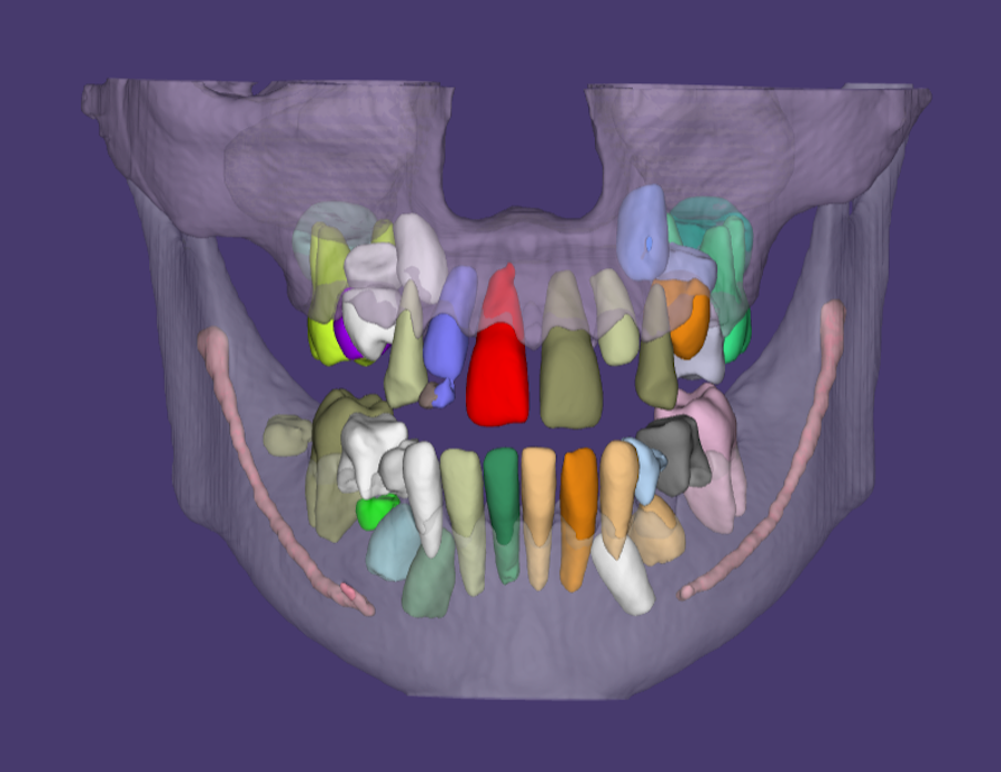 3D-снимок полости рта