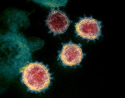Фото SARS-CoV-2 &mdash; вируса, вызывающего COVID-19. S-белки окружают внешний слой каждой вирусной частицы