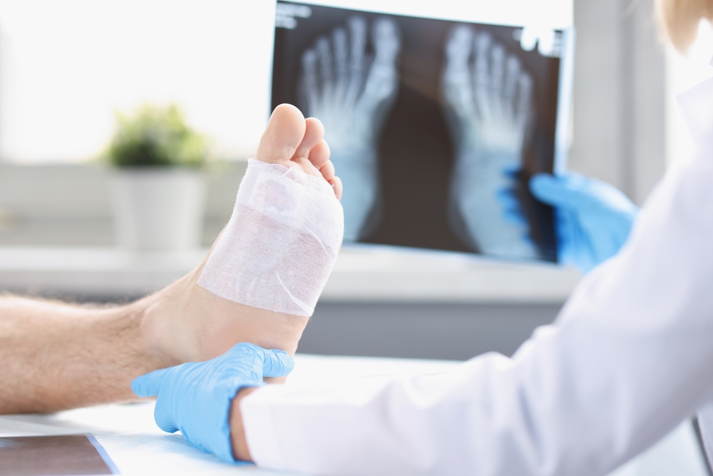 Травмы пальца на ноге: особенности лечения