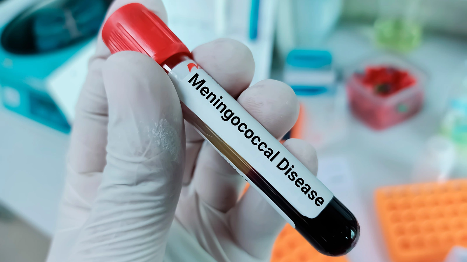 Менингококковая инфекция стала круглогодично активной. Как защититься