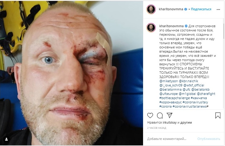 Харитонов показал свое лицо после избиения Яндиевым. Фото