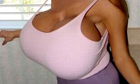 Фотогалерея увеличение груди при помощи имплантов До и После