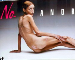 Во Франции скончалась самая известная модель-анорексичка 