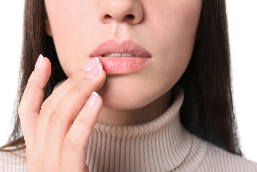 Как лечить обветренные губы