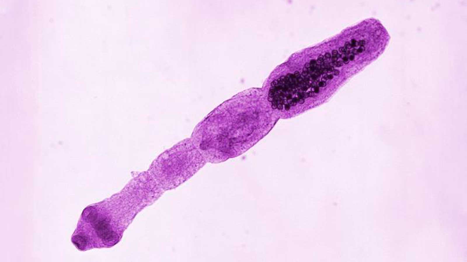 <p>Echinococcus multilocularis</p>