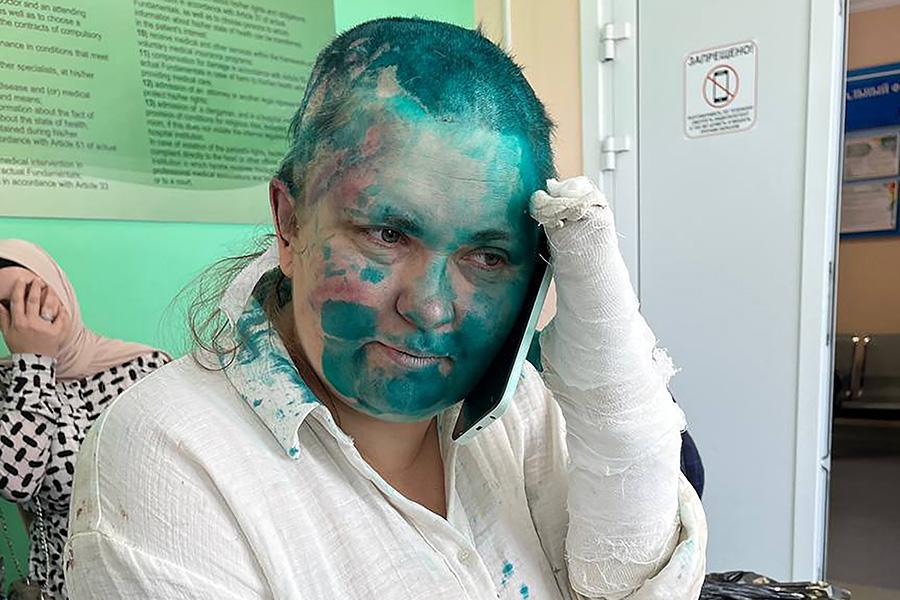 Елена Милашина&nbsp;после нападения в Грозном, 2023 год