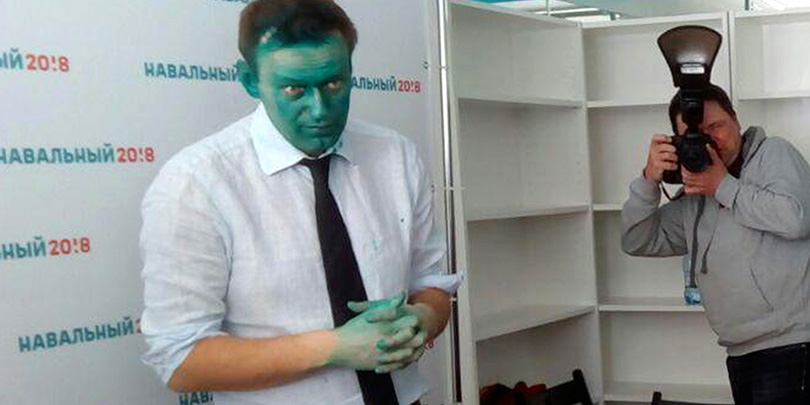 Навальный рассказал о прошедшей в Барселоне операции на глазу