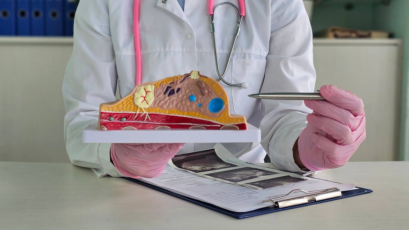 Англичанка перепутала симптом агрессивного рака с усталостью. Подробности