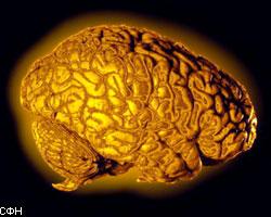 Медики открыли новое заболевание мозга