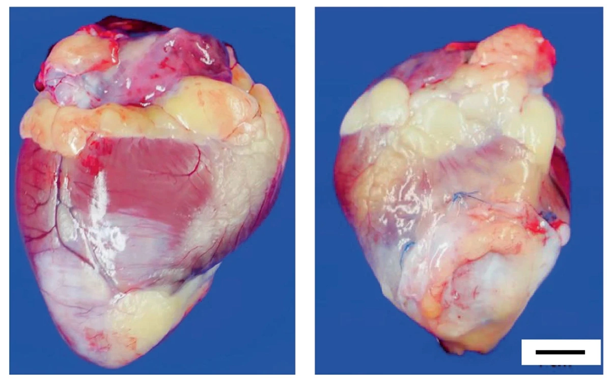 Сердце макаки-резуса без трансплантата (слева) и с трансплантатом через шесть месяцев после приживления пластыря