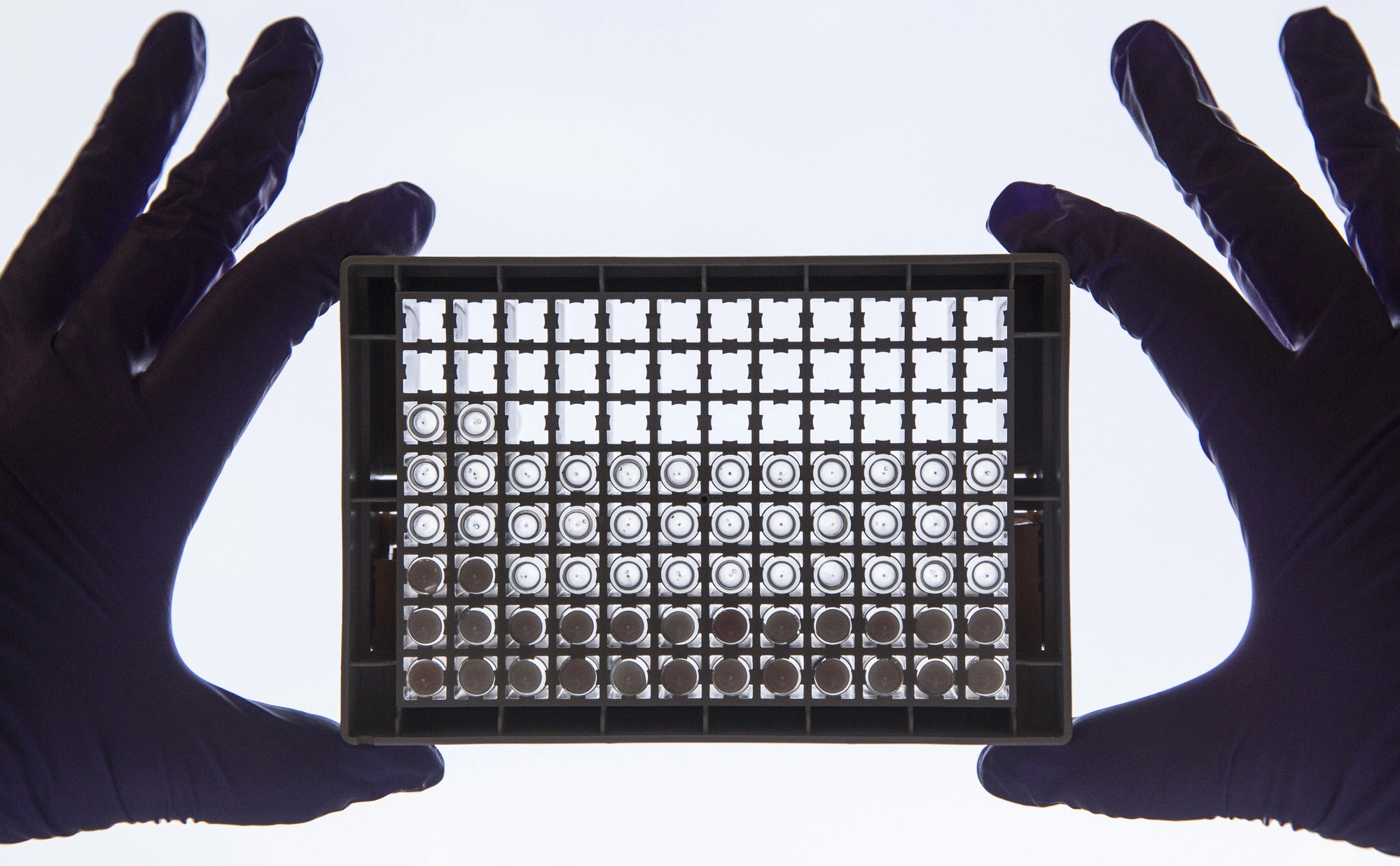  Dan Kitwood / Getty Images / Cancer Research UK