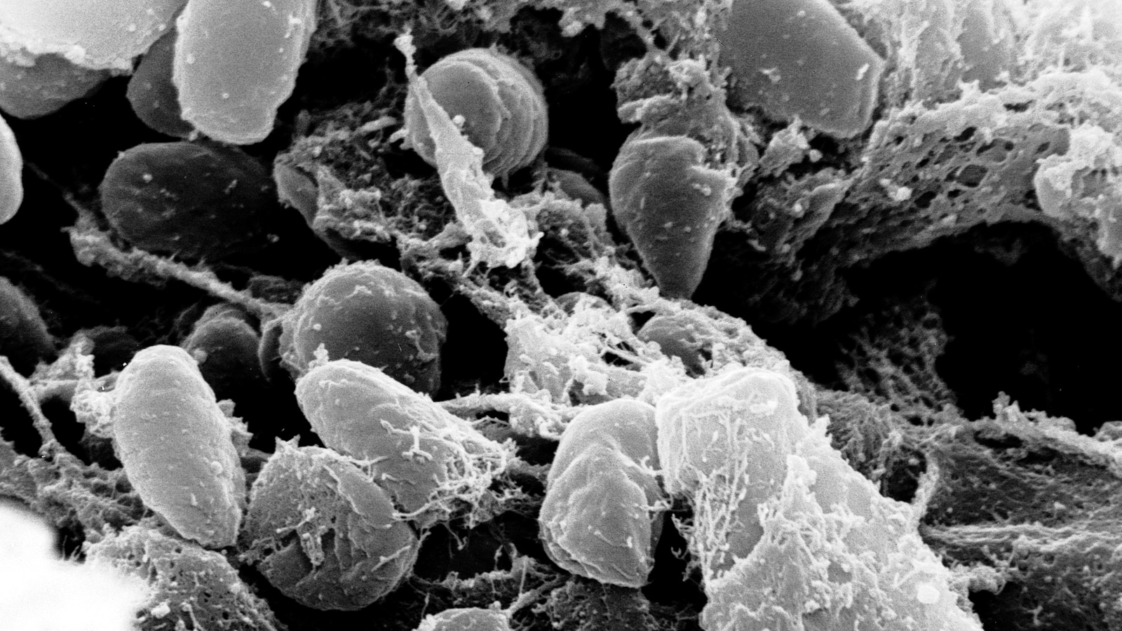 Микроорганизм Yersinia pestis