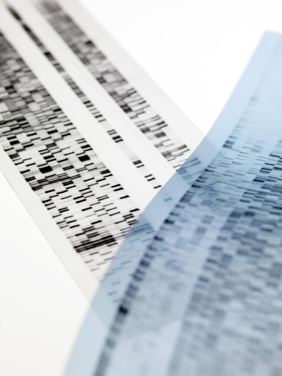 Фото: SCIENCE PHOTO LIBRARY - TEK IMAGE. / GETTY IMAGES