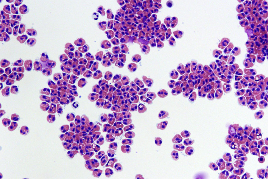 Эозинофилы &mdash; это одна из пяти разновидностей лейкоцитов, или белых кровяных телец