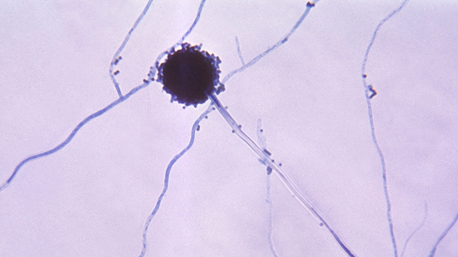 Грибок Aspergillus