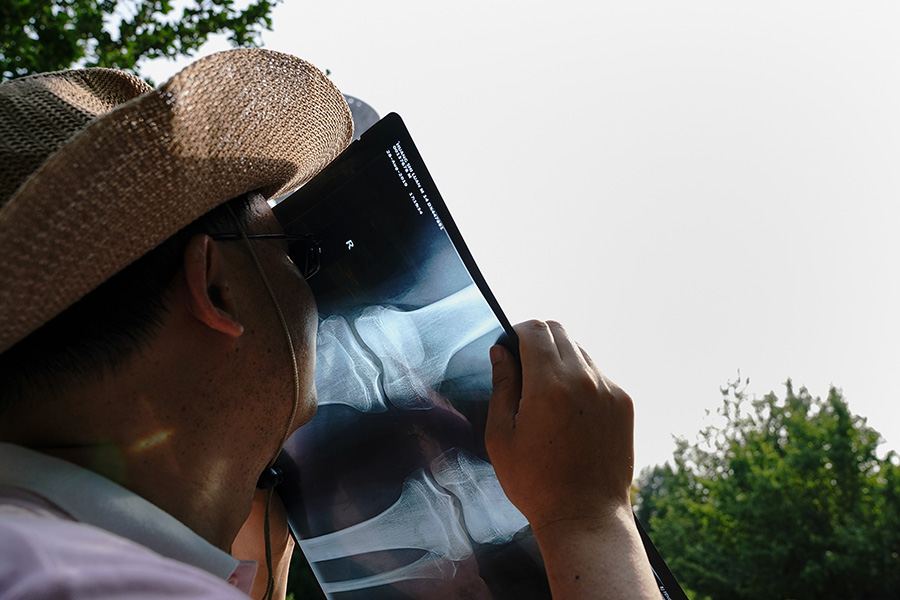 Мужчина в Китае использует снимок компьютерной томографии для наблюдения за солнечным затмением