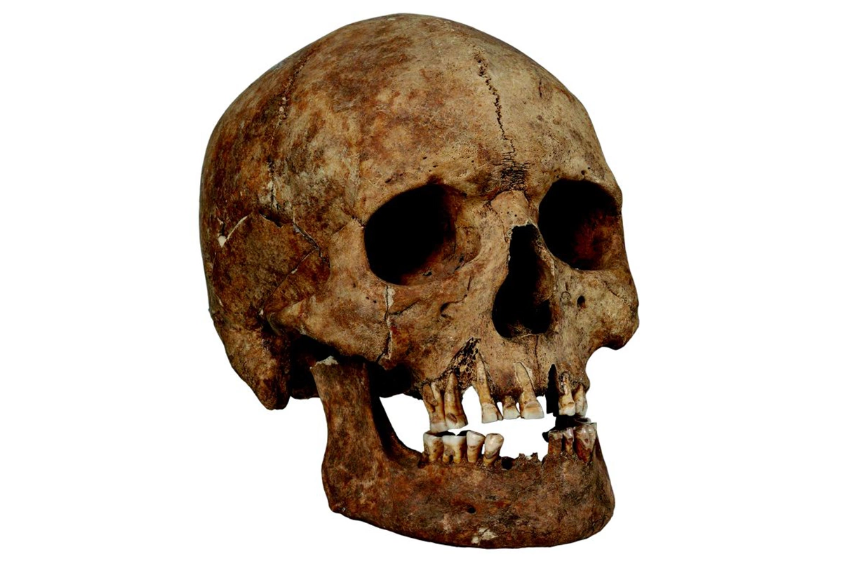 Череп с подпиленными зубами, найденный на острове Готланд