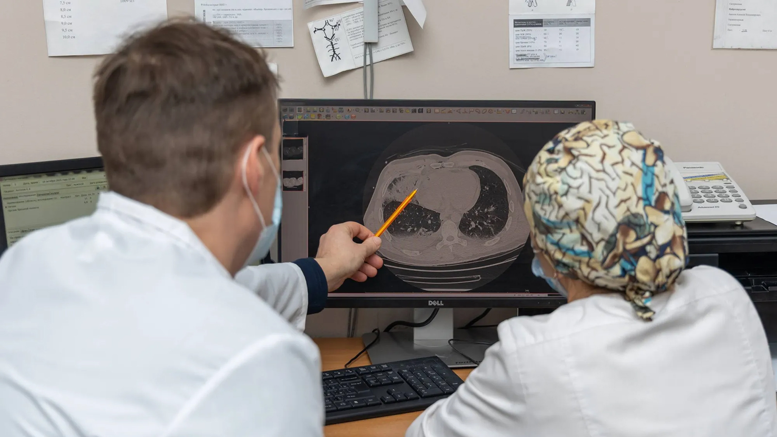 Хирурги в Екатеринбурге спасли пациента с пулей в критической зоне сердца