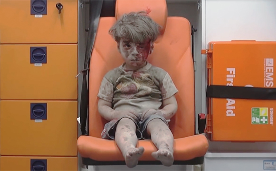Мальчик Омран, который&nbsp;был ранен во&nbsp;время авиаудара по&nbsp;району Аль-Кватерджи сирийского города Алеппо, 17 августа 2016 года
