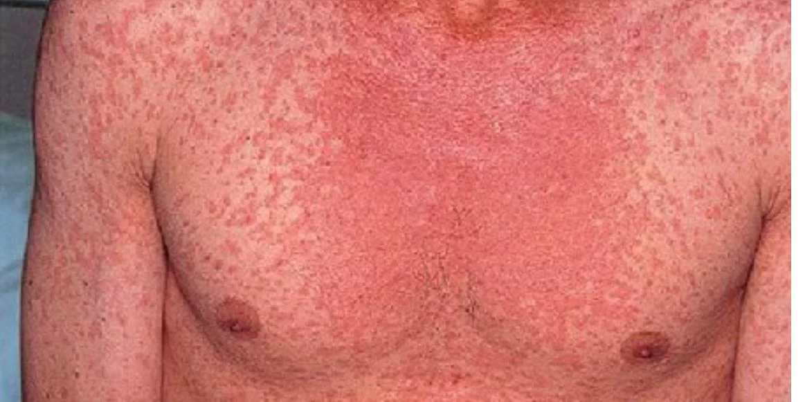 Кольчугинская центральная районная больница