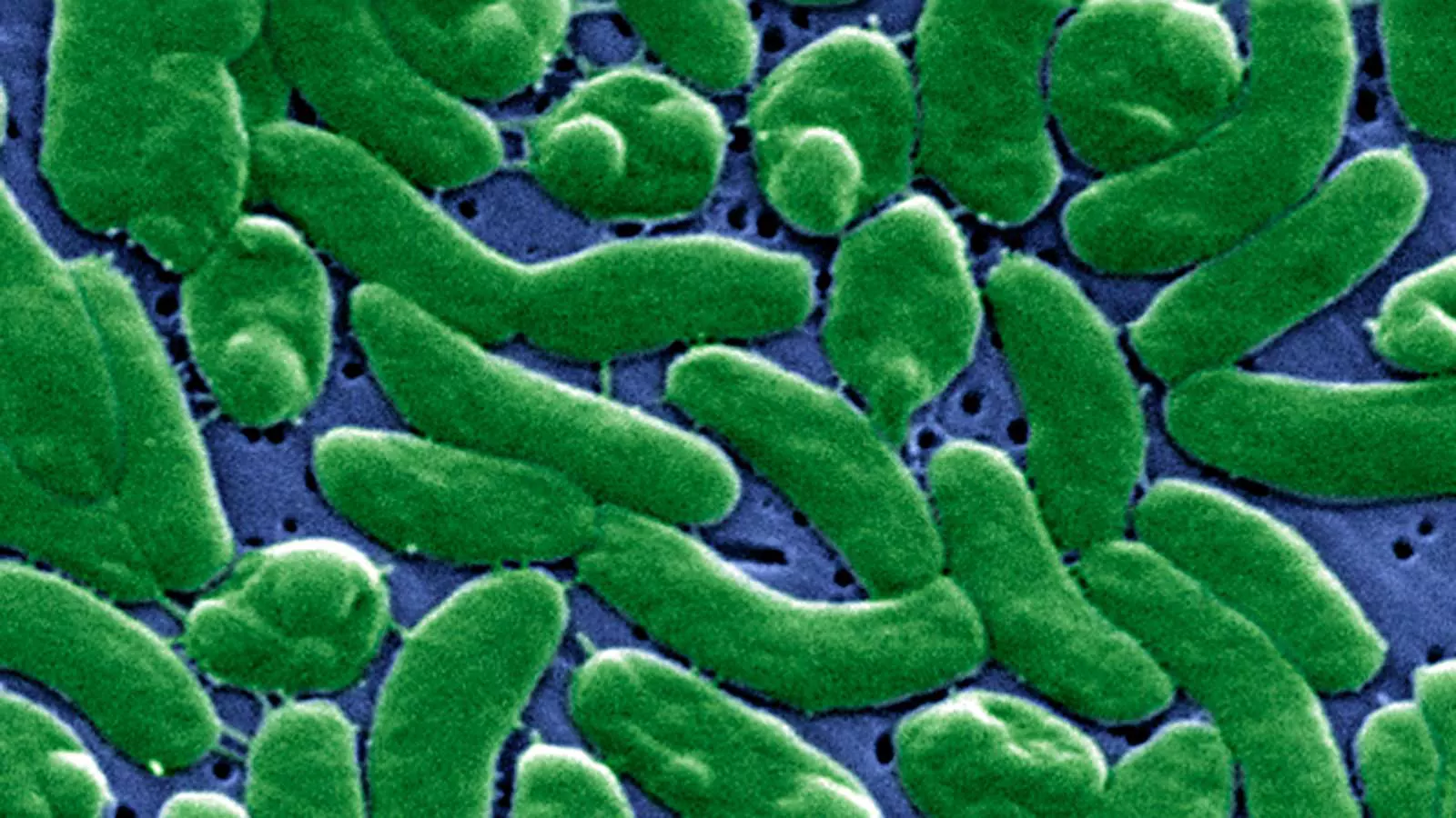 Плотоядная бактерия Vibrio vulnificus