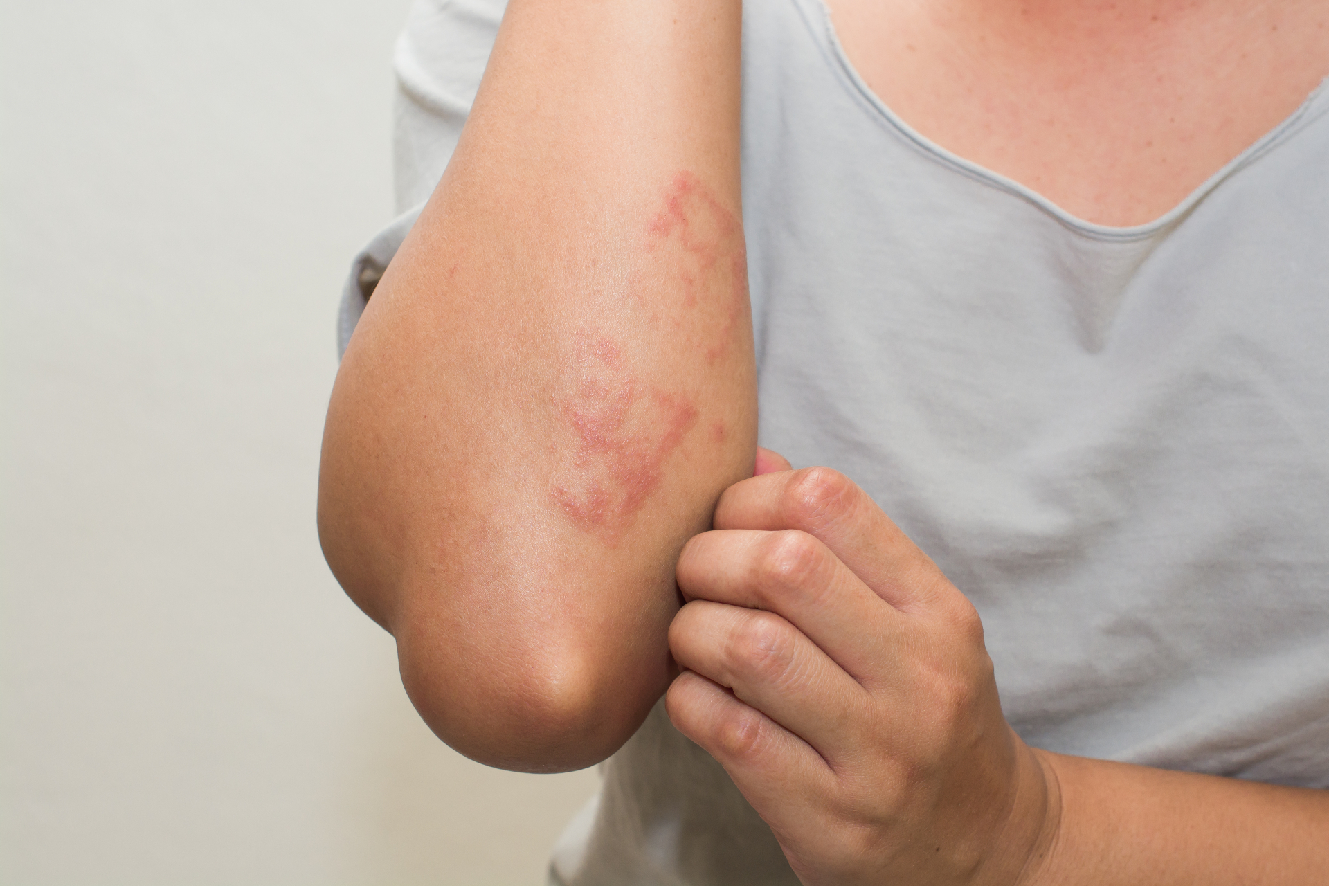 Шелушится кожа после шугаринга – причины явления и способы устранения проблемы