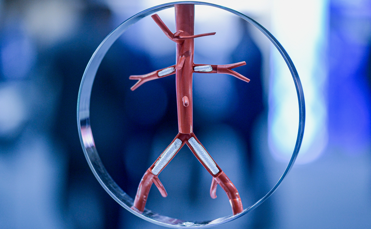 Модель тромбоза в организме человека
