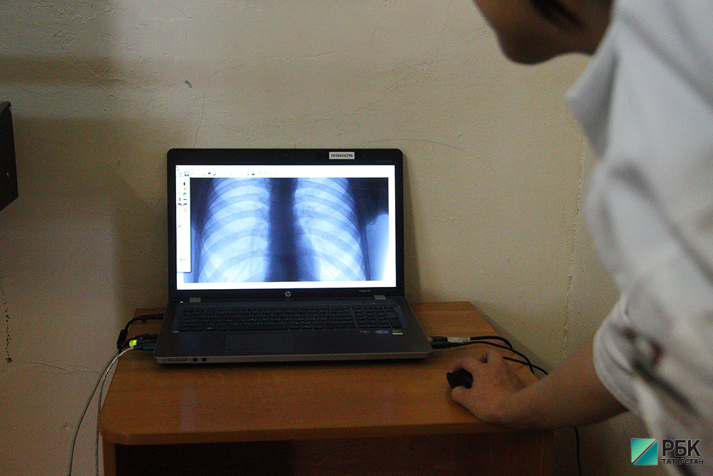 В Татарстане снизилась смертность от туберкулеза