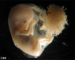 Британцы клонировали эмбрион человека