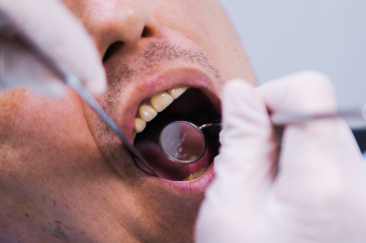 Тюменские стоматологии изменили цены на лечение зубов