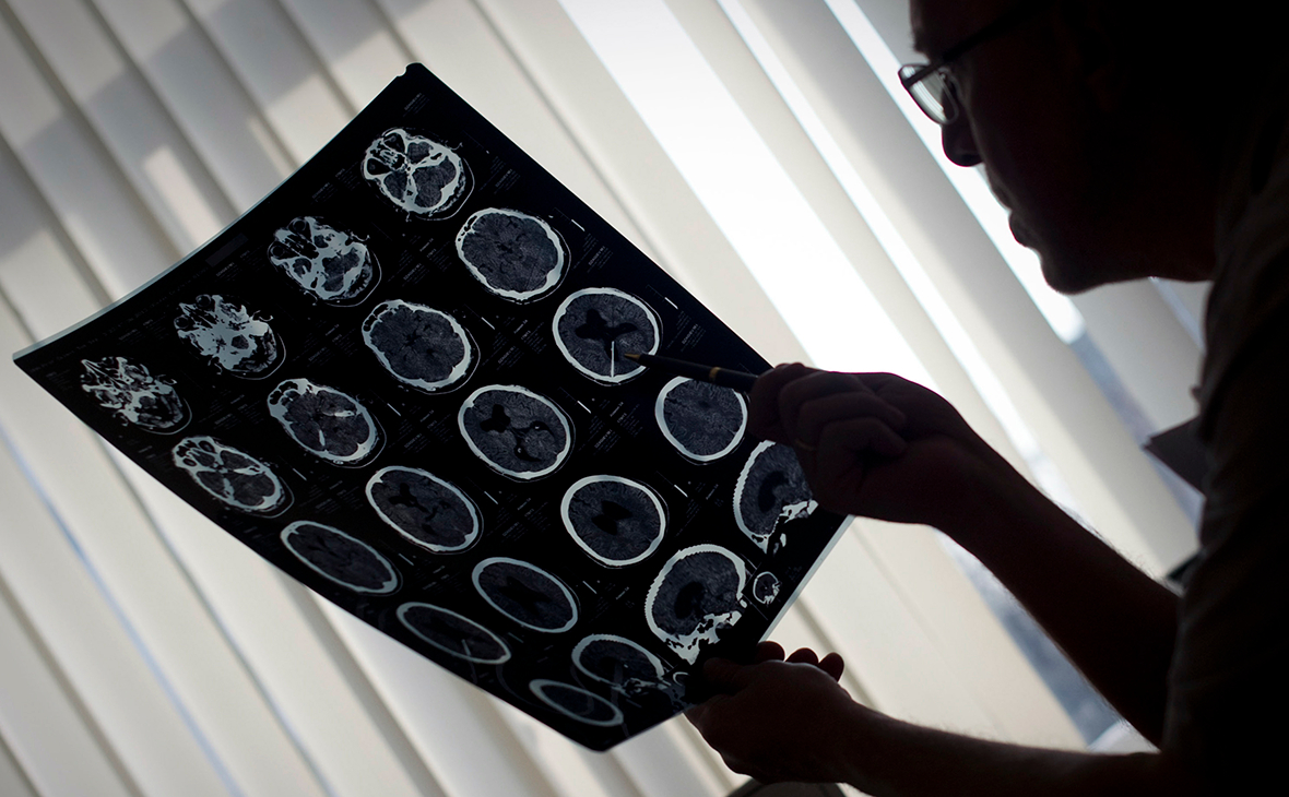 Онколог перечислил самые распространенные симптомы рака головного мозга —  РБК