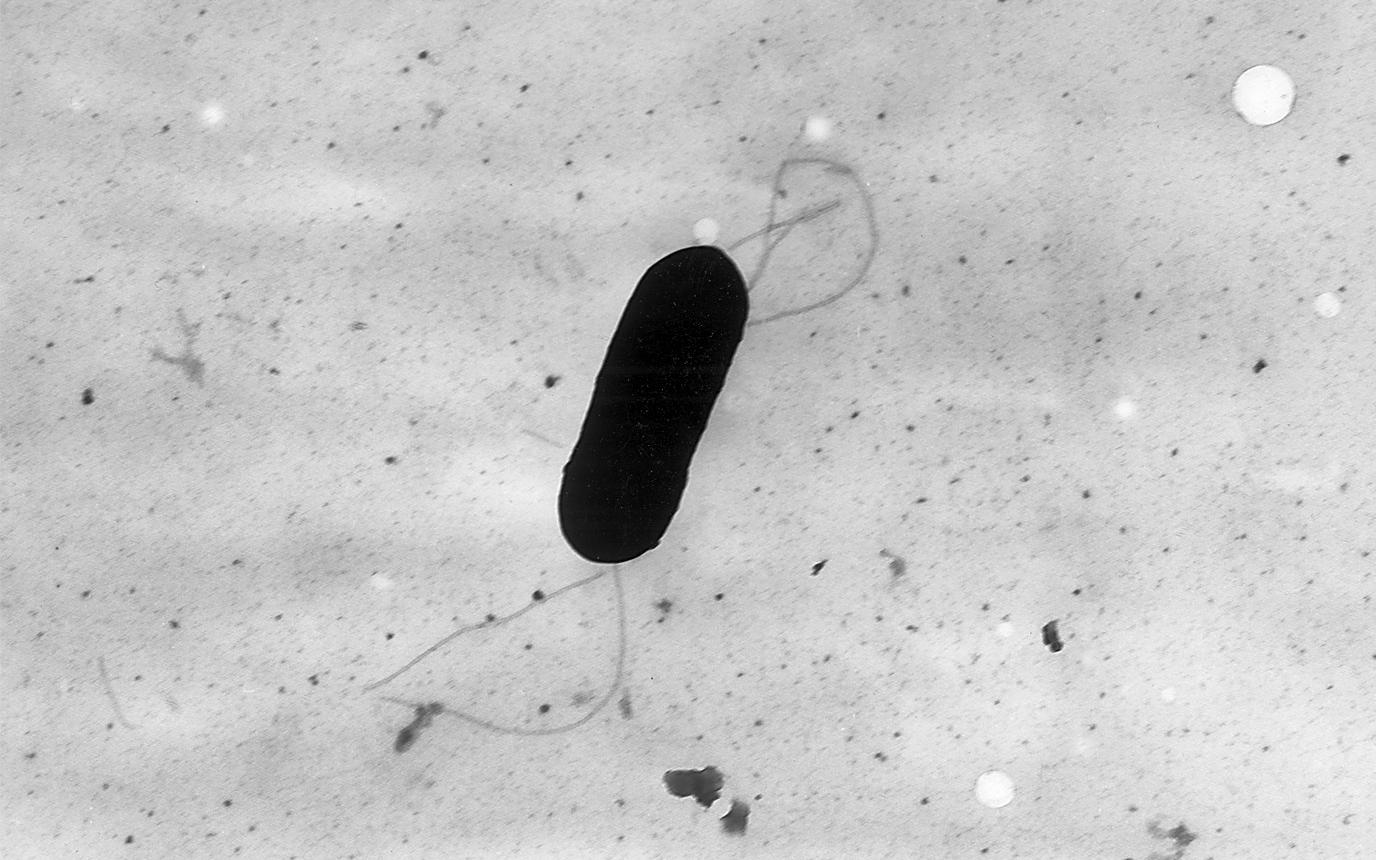 Электронная микрофотография жгутиковой бактерии Listeria monocytogenes