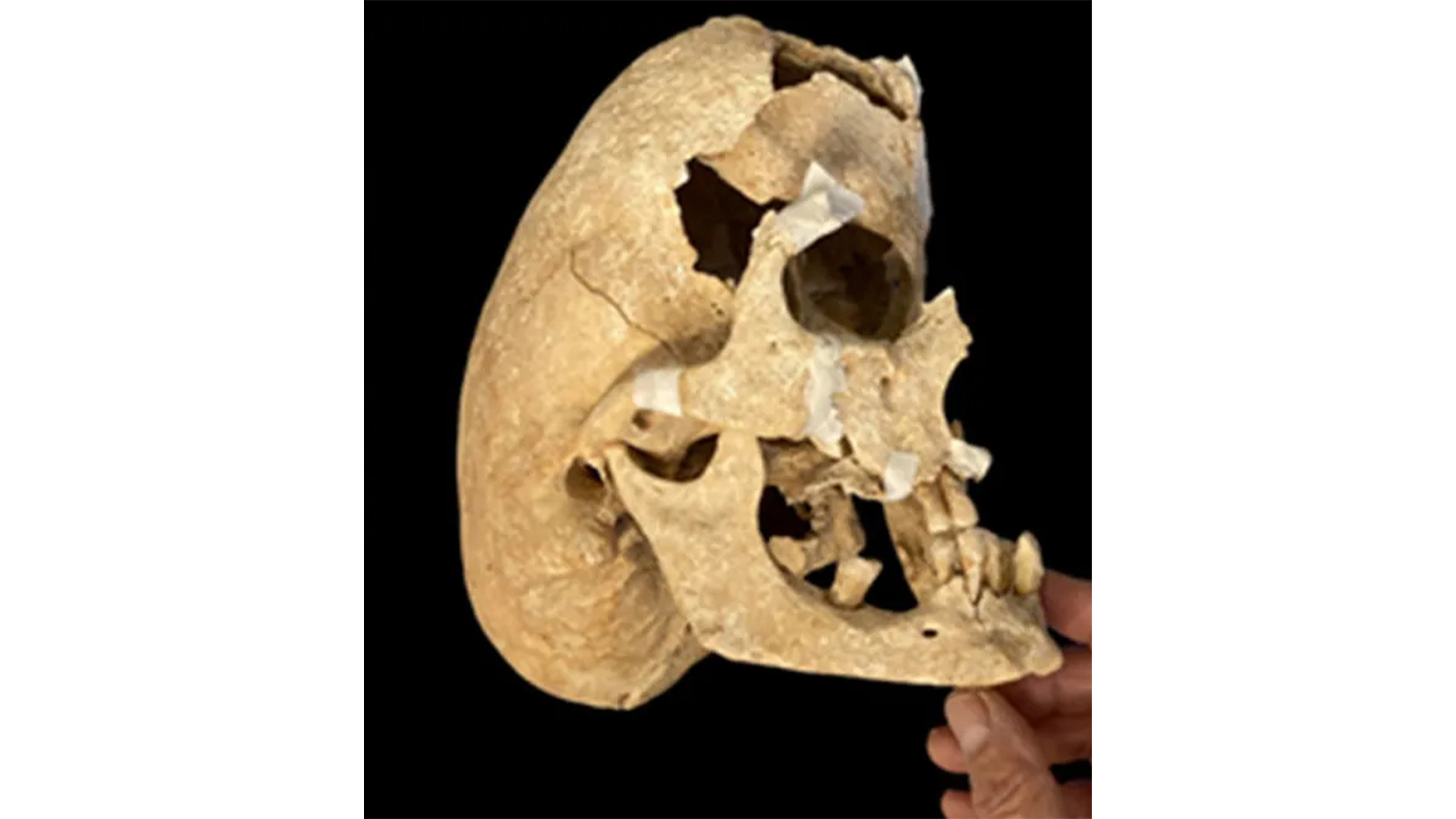 Останки мужчины с черепом необычной формы