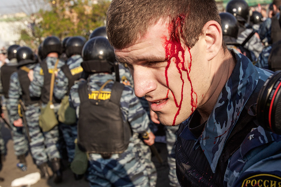 Пострадавший в ходе беспорядков на Болотной площади. 6 мая 2012 года