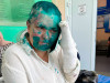 Елена Милашина после атаки