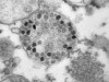 Вирусы &laquo;омикрон-штамма&raquo; разной формы в пузырьках эндоплазматической сети клеток Vero Е6