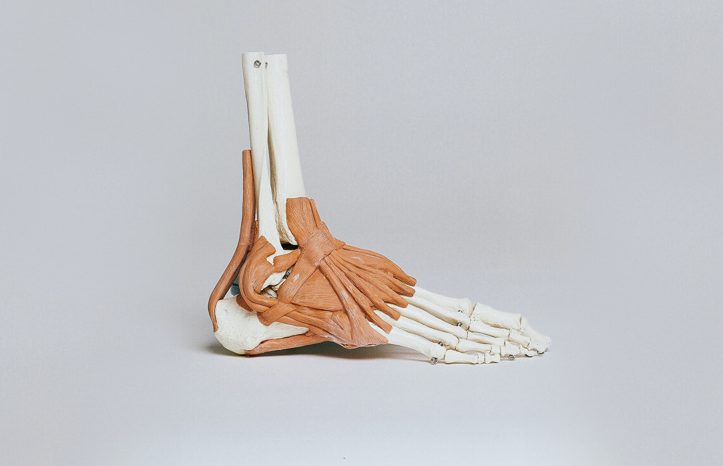 При переломах костей конечностей чтобы обездвижить сломанную кость thumbnail