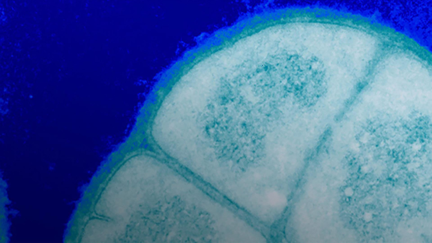 Грамположительный, экстремофильный кокк рода Deinococcus — один из самых устойчивых к действию ионизирующего излучения видов бактерий 