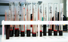 В лаборатории, где исследуют кровь на наличие ВИЧ


