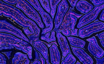 <p>&laquo;Гранд-Каньон&raquo; фотография, показывающая поперечное сечение кишечника мыши</p>