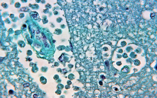 Амеба&nbsp;Naegleria fowleri