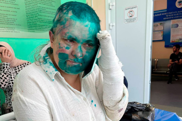 Елена Милашина после атаки