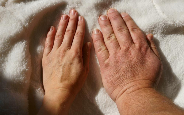 Фото:Shutterstock