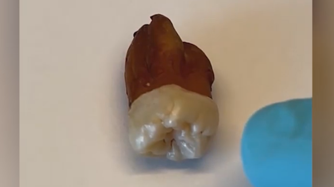 Обложка видео